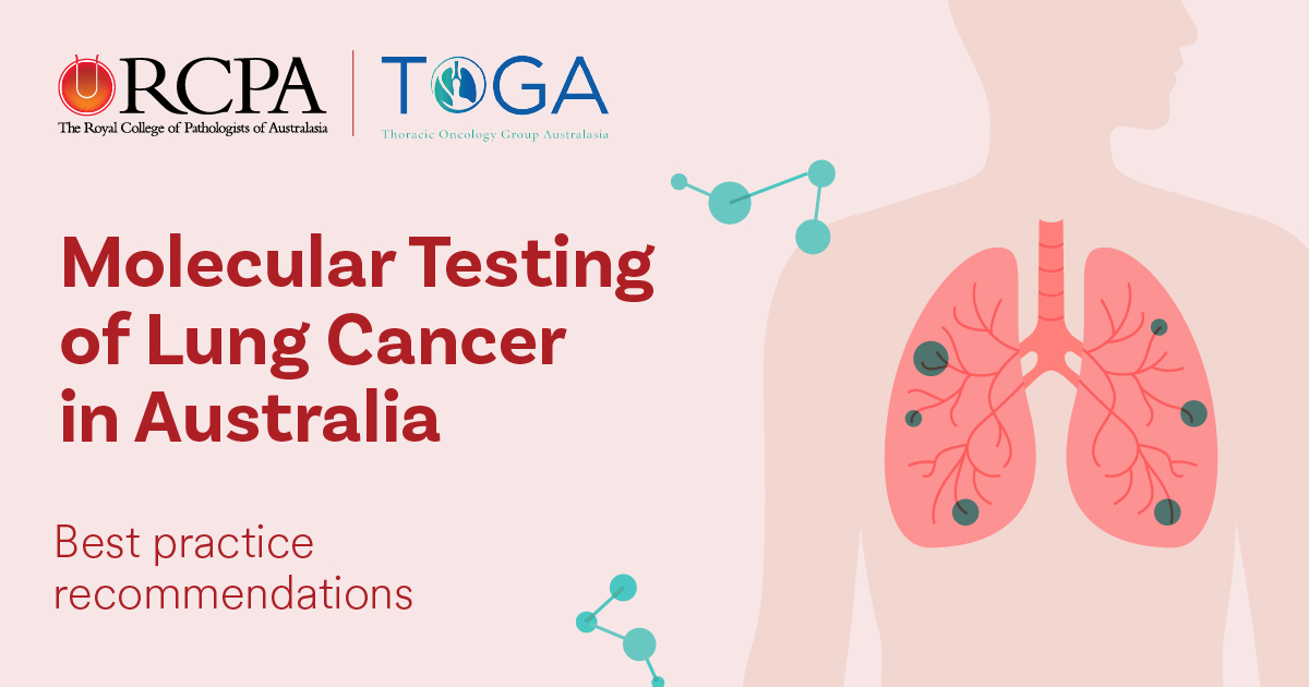 Pathology Journal (@pathology_rcpa) on Twitter photo See the editorial in the June issue of #Pathology from molecular pathologist Dr Vivek Rathi. This provides clinical context for the best practice recommendations for molecular testing of #LungCancer developed by <a href="/PathologyRCPA/">The Royal College of Pathologists of Australasia</a> and <a href="/TOGAANZ/">Thoracic Oncology Group of Australasia</a> (free to download): See the editorial in the June issue of #Pathology from molecular pathologist Dr Vivek Rathi. This provides clinical context for the best practice recommendations for molecular testing of #LungCancer developed by <a href="/PathologyRCPA/">The Royal College of Pathologists of Australasia</a> and <a href="/TOGAANZ/">Thoracic Oncology Group of Australasia</a> (free to download):