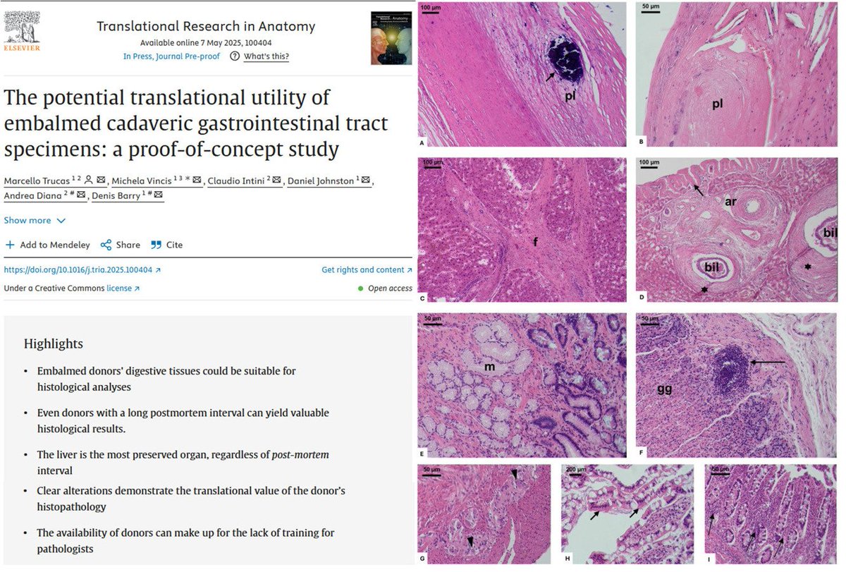 Marcello Trucas (@trucasmarcello) on Twitter photo Glad to share our latest work, wich sheds light on the great potential of Donors on histological research in chronic intest and liver diseases and on atherosclerosis.👇 sciencedirect.com/science/articl… Team work in <a href="/AnatomyTrinity/">AnatomyTCD</a> & <a href="/AOUCagliari/">AOU Cagliari</a>
<a href="/DS_Barry/">Denis Barry</a> <a href="/DannyJohnston2/">Danny Johnston</a> <a href="/claudio_intini/">Claudio Intini</a> Glad to share our latest work, wich sheds light on the great potential of Donors on histological research in chronic intest and liver diseases and on atherosclerosis.👇 sciencedirect.com/science/articl… Team work in <a href="/AnatomyTrinity/">AnatomyTCD</a> & <a href="/AOUCagliari/">AOU Cagliari</a>
<a href="/DS_Barry/">Denis Barry</a> <a href="/DannyJohnston2/">Danny Johnston</a> <a href="/claudio_intini/">Claudio Intini</a>