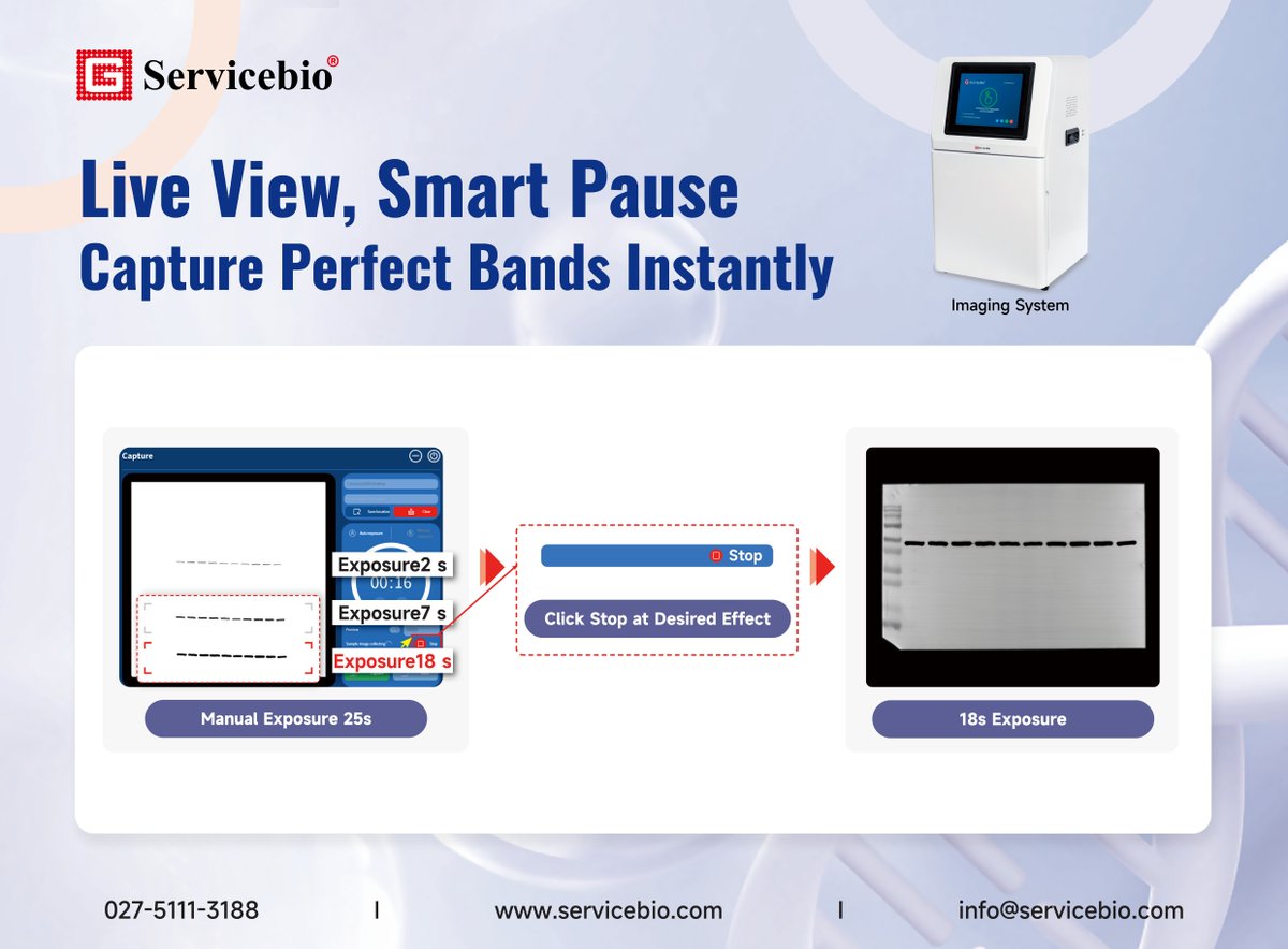 WUHANSERVICEBIO's tweet image. 5 Hidden Superpowers You Didn’t Know About Servicebio Imaging System
🚀 Superpower #5: Pause &amp;amp; Save Perfect Blots Mid-Run!
See a good band?
→ Click stop ⏸️
→ Save &amp;amp; go 🏃♂️
→ No full-exposure jail time! 🔓
#WesternBlot #LabInstrument #Chemiluminescence #Servicebio