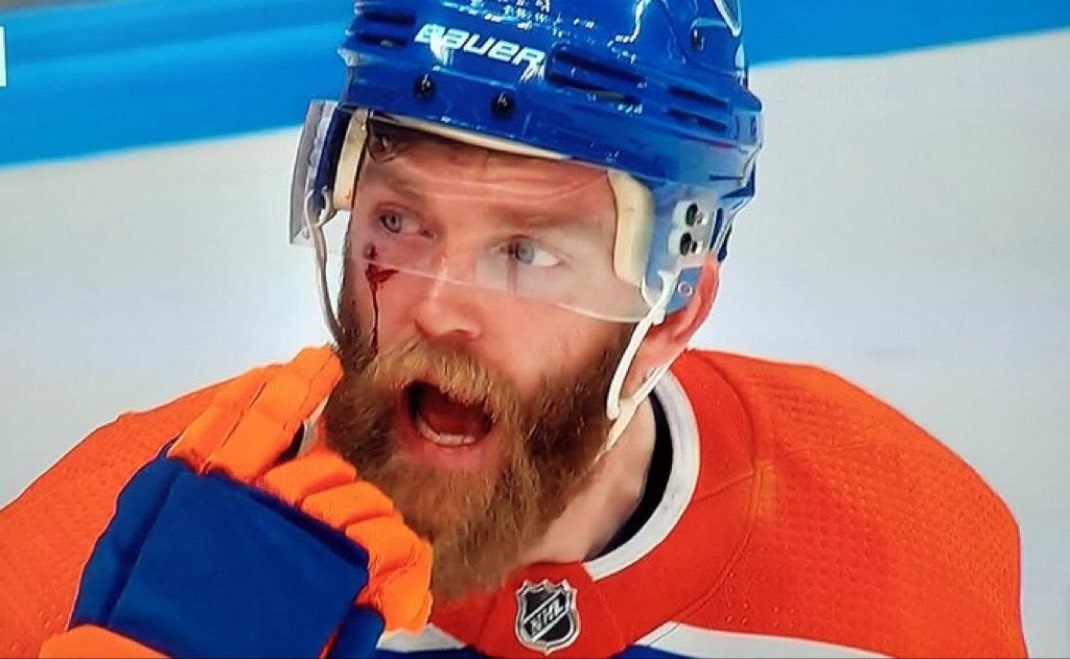 <a href="/BarDown/">BarDown</a> Missed call you say? Just like last time these teams met?