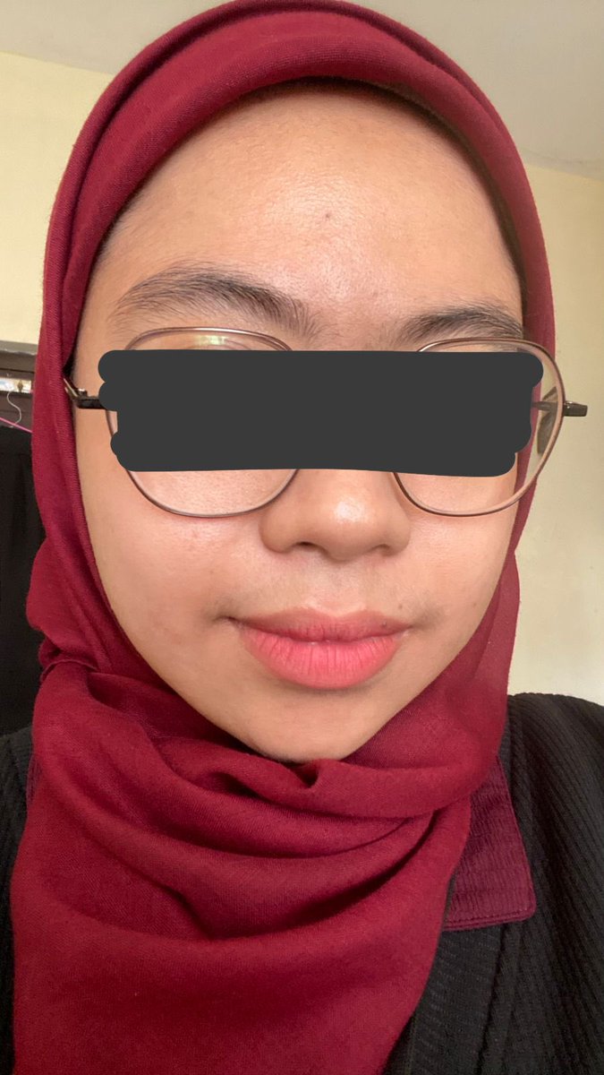 Baru kali ini ikut nyoba yang viral terkait perskincare-an dan cukup works di gw huhu. Pemakaian 2 mingguan, gw ngerasa kulit lebih cerah dan jerawat lebih kalem terus cepet pergi tanpa bekas. Terima kasih niacef dan glycore 🫶🏻🫶🏻