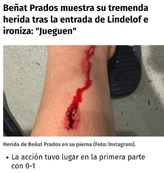 Enhorabuena al Manchester. Justo ganador.
Pero.. min 68, con 0-1 y esta entrada a Prados. Ni falta, ni amarilla, ni roja. Para que está el VAR? 
Por cierto, acabó lesionado.
Aupa Athletic! 🔴⚪️
#AthleticClub #ManchesterUnited #UEL