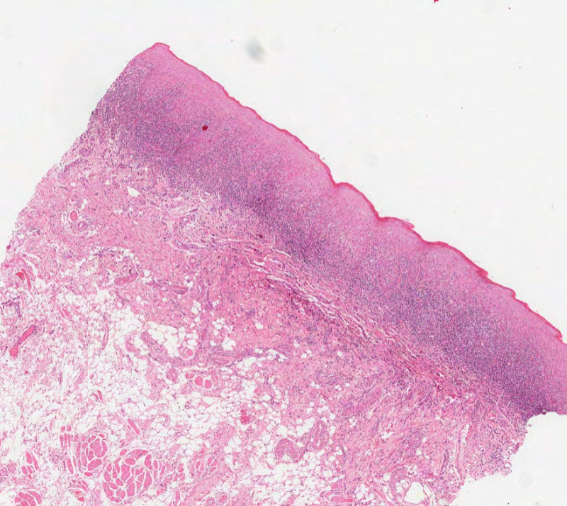 Virtual Pathology at The University of Leeds tweet media