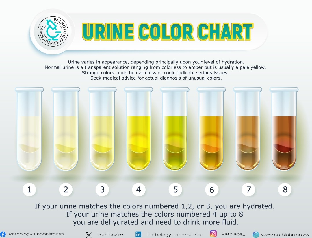 Pathlabzim's tweet image. #Funfactfriday
Your urine can tell you a lot about your health and your habits. 

Certain changes in your urine or urine habits, either during or after urination, may indicate that you have a medical condition.

Pay attention to your pee. It might just save your life. 

#wecare