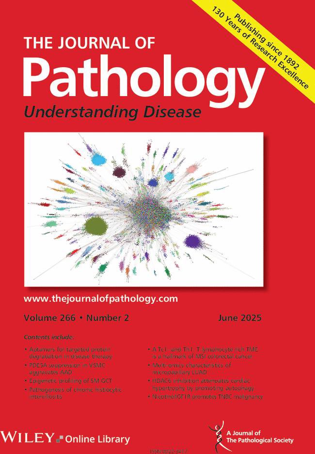 Pathological Society (@pathsoc) on Twitter photo The June issue of #TheJournalOfPathology is now live! …thsocjournals.onlinelibrary.wiley.com/toc/10969896/2…
Cover image: A Tc1- and Th1-T-lymphocyte-rich tumor microenvironment is a hallmark of MSI #colorectal #cancer
…thsocjournals.onlinelibrary.wiley.com/doi/10.1002/pa…
#Pathology #TranslationalMedicine #PathSoc The June issue of #TheJournalOfPathology is now live! …thsocjournals.onlinelibrary.wiley.com/toc/10969896/2…
Cover image: A Tc1- and Th1-T-lymphocyte-rich tumor microenvironment is a hallmark of MSI #colorectal #cancer
…thsocjournals.onlinelibrary.wiley.com/doi/10.1002/pa…
#Pathology #TranslationalMedicine #PathSoc
