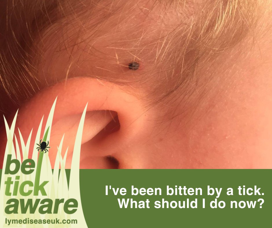 Please follow the guidance written in our full guide to tick bites and acute Lyme disease:

lymediseaseuk.com/patient-inform…

#BeTickAware #LymeDiseaseAwarenessMonth