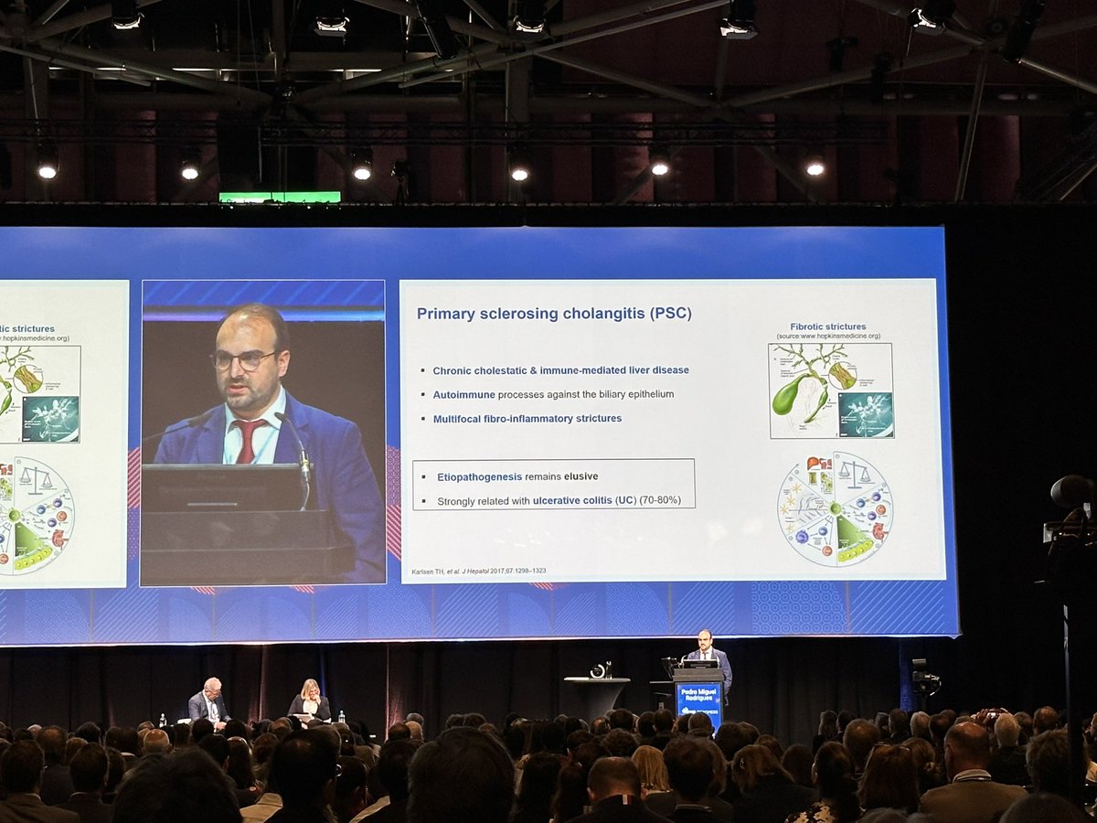 Rui Castro (@ruicastrohd) on Twitter photo #EASLCongress General Session 2
<a href="/PMRodrigues19/">Pedro Rodrigues</a> presents a novel 3-in-1 blood metabolomic test for the early diagnosis & risk stratification of PSC & CCA
👏🏼👏🏼👏🏼
<a href="/JesusMBanales/">Jesus Bañales</a> <a href="/EASLnews/">EASLnews</a> #EASLCongress General Session 2
<a href="/PMRodrigues19/">Pedro Rodrigues</a> presents a novel 3-in-1 blood metabolomic test for the early diagnosis & risk stratification of PSC & CCA
👏🏼👏🏼👏🏼
<a href="/JesusMBanales/">Jesus Bañales</a> <a href="/EASLnews/">EASLnews</a>