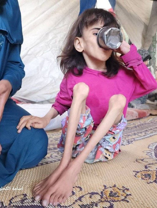 ayahh2001's tweet photo. Famine in Gaza is stealing children's lives and childhoods.
Empty stomachs, searching eyes, and silent suffering.
The world watches as they fade away each day.
#endgaza #GazaNeedsHelp #gazaldying #FreePalestine #FREEDVM #Gazableeds #fumata #GazaStarving #endthegenocide #Gaza https://t.co/178XU2XCEk
