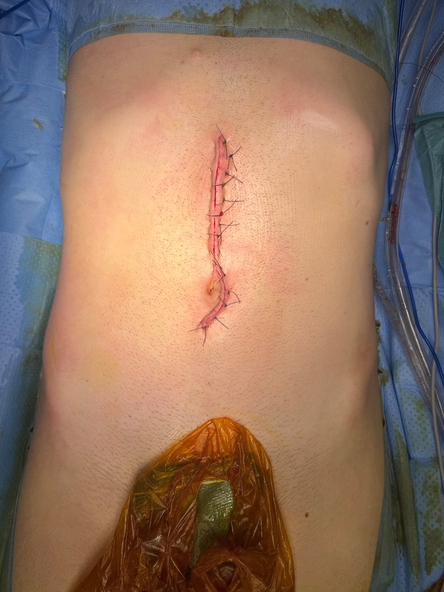 Xavier Berard tweet media