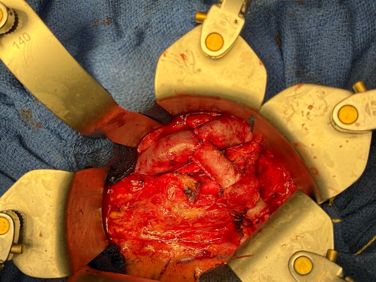 Xavier Berard tweet media