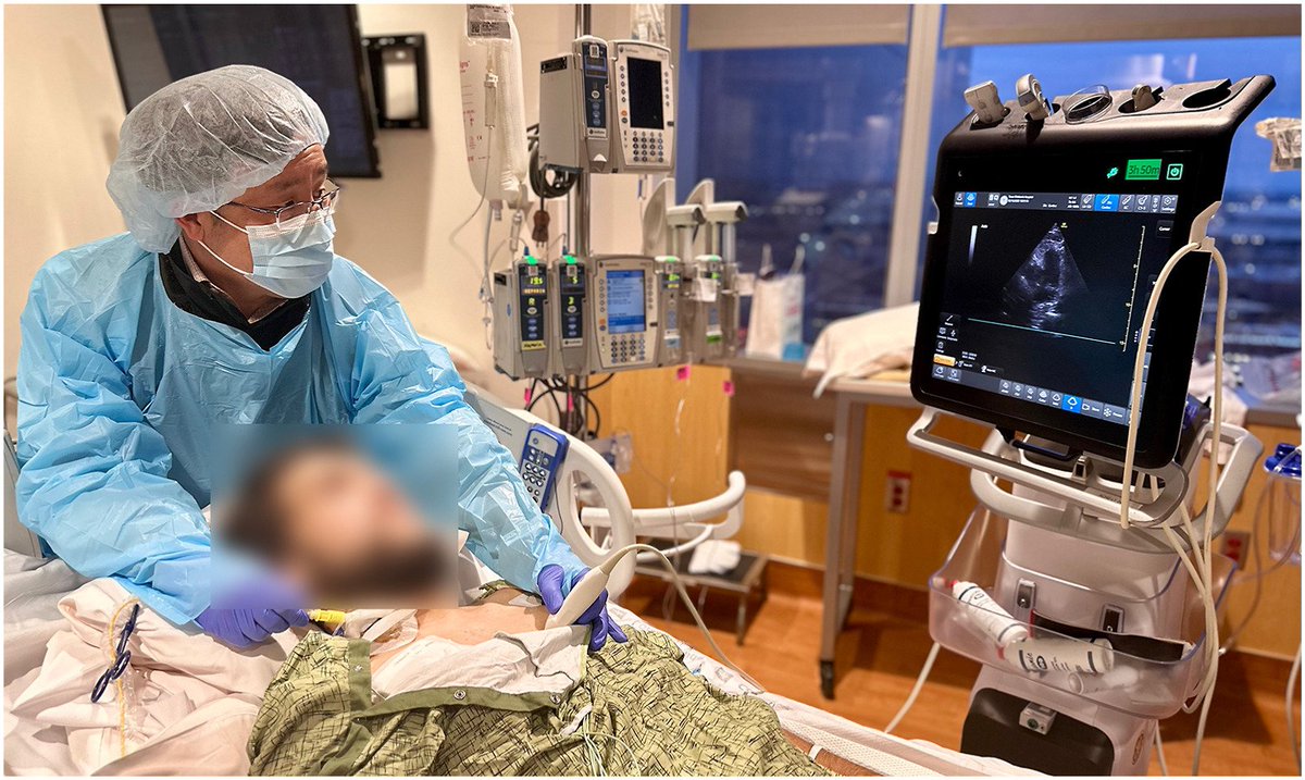 V.L.Sorrell, MD (@CASEfromASE EIC) (@vlsorrellimages) on Twitter photo #JADEL
Just dropped in CASE <a href="/CASEfromASE/">CV Case Journal</a>
doi.org/10.1016/j.case…
POCUS-guided PA catheter (single operator)!
<a href="/SCCM/">SCCM</a> <a href="/hillersond/">Dustin Hillerson, MD</a> <a href="/Crit_Care/">Critical Care</a> <a href="/JonahRubinMD/">Jonah Rubin MD, FCCP</a> <a href="/OrenFriedman/">Oren Friedman</a> <a href="/GoughCJ/">Chris Gough</a> <a href="/nat_echo/">Natasha</a> <a href="/eddyjoemd/">Eddy J. Gutierrez, MD</a> <a href="/PittCCM/">Pitt Critical Care Medicine</a>
<a href="/ASE360/">American Society of Echocardiography</a> #JADEL
Just dropped in CASE <a href="/CASEfromASE/">CV Case Journal</a>
doi.org/10.1016/j.case…
POCUS-guided PA catheter (single operator)!
<a href="/SCCM/">SCCM</a> <a href="/hillersond/">Dustin Hillerson, MD</a> <a href="/Crit_Care/">Critical Care</a> <a href="/JonahRubinMD/">Jonah Rubin MD, FCCP</a> <a href="/OrenFriedman/">Oren Friedman</a> <a href="/GoughCJ/">Chris Gough</a> <a href="/nat_echo/">Natasha</a> <a href="/eddyjoemd/">Eddy J. Gutierrez, MD</a> <a href="/PittCCM/">Pitt Critical Care Medicine</a>
<a href="/ASE360/">American Society of Echocardiography</a>