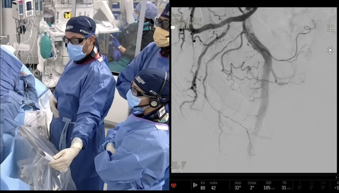 Mount Sinai IR (@mountsinaiir) on Twitter photo LIVE <a href="/MountSinaiIR/">Mount Sinai IR</a> Join us for this weeks #TREATLIVE case! #PAE #IRad treatsymposium.com LIVE <a href="/MountSinaiIR/">Mount Sinai IR</a> Join us for this weeks #TREATLIVE case! #PAE #IRad treatsymposium.com