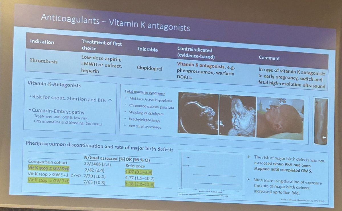 Cassy Sims, MD (@drcassysims) on Twitter photo Pregnant patients exposed to vitamin K antagonists (warfarin) are at increased risk for: <a href="/RheumNow/">Dr. John Cush</a>
👶 fetal warfarin syndrome (facial/vertebral abnormalities)
🤰spontaneous abortion
👶 embryopathy
Patients can be switched to LMWH or unfractionated heparin, ASA in pregnancy Pregnant patients exposed to vitamin K antagonists (warfarin) are at increased risk for: <a href="/RheumNow/">Dr. John Cush</a>
👶 fetal warfarin syndrome (facial/vertebral abnormalities)
🤰spontaneous abortion
👶 embryopathy
Patients can be switched to LMWH or unfractionated heparin, ASA in pregnancy