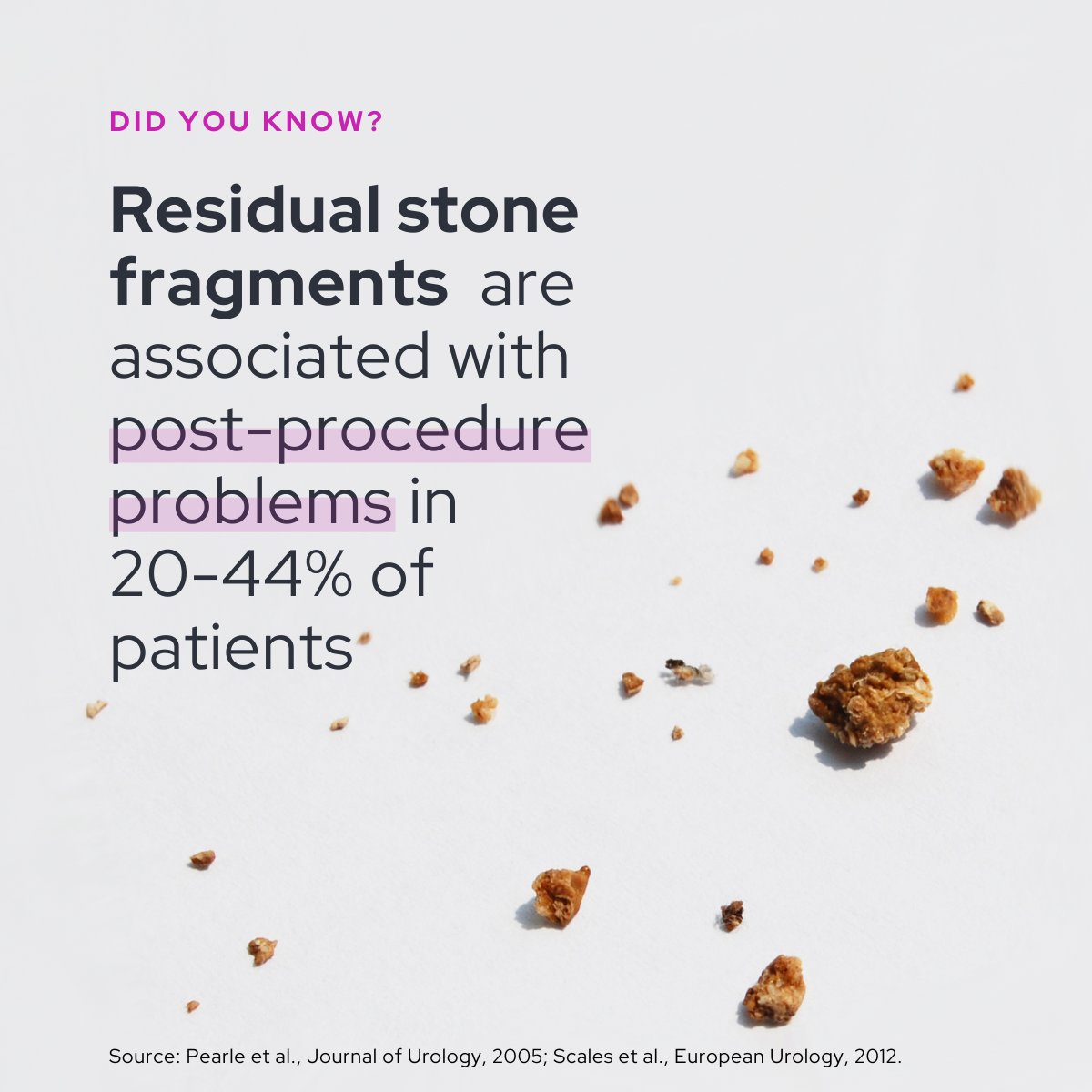 🌟 20%-44% of kidney stone patients experience issues like pain &amp; infection post-procedure due to residual fragments.​

CVAC System is a revolutionary system for complete stone clearance: calyxoinc.com/calyxo-cvac-sy… ​
​
#NoStoneLeftBehind #CalyxoCVAC #KidneyStoneTreatment