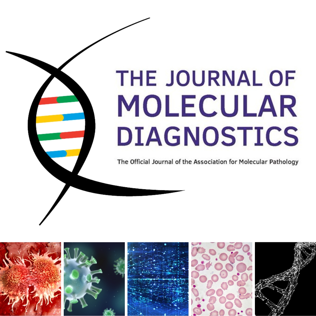 Association for Molecular Pathology (@ampath) on Twitter photo Consider submission to <a href="/JMDiagn/">The Journal of Molecular Diagnostics</a>, the official Journal of <a href="/AMPath/">Association for Molecular Pathology</a>, for your next #moldx #molpath paper. JMD considers papers from all 5 AMP subdivisions- #solidtumor, #informatics, #infectiousdisease, #genetics, and #hematopathology.
Submit today!
editorialmanager.com/jmdi/default2.… Consider submission to <a href="/JMDiagn/">The Journal of Molecular Diagnostics</a>, the official Journal of <a href="/AMPath/">Association for Molecular Pathology</a>, for your next #moldx #molpath paper. JMD considers papers from all 5 AMP subdivisions- #solidtumor, #informatics, #infectiousdisease, #genetics, and #hematopathology.
Submit today!
editorialmanager.com/jmdi/default2.…