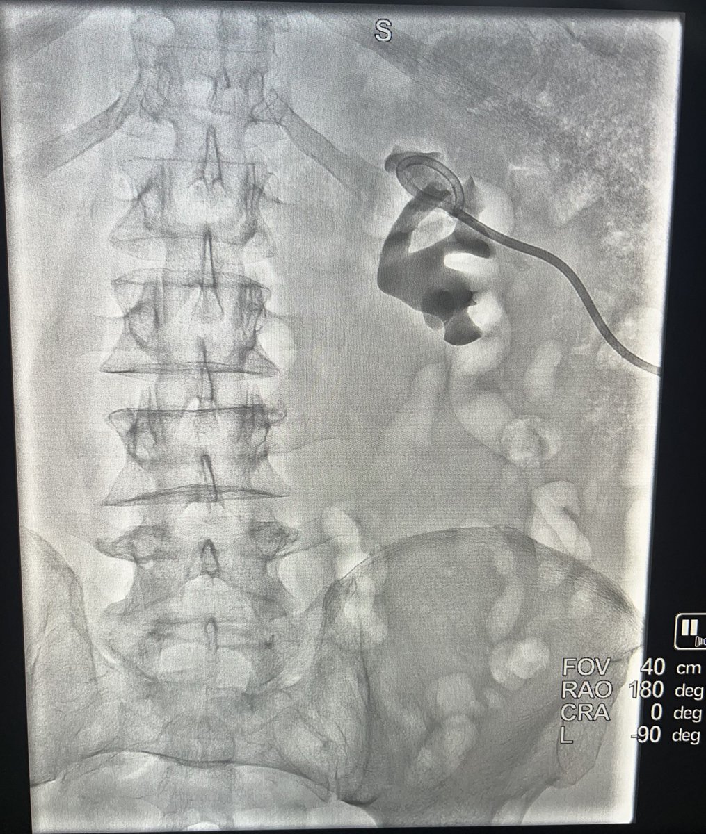 The IR team Liked the excellent image quality, user-friendly interface, Mobility of the system &amp; wireless Mouse to control Advanced Application from table-side

A big Thanks to Dr. <a href="/drgharem/">Nasser Algharem</a> who leads IR team as well as to Dr. <a href="/Dr1Irad/">الدكتور محمد آل مطلق. Dr.Mohammed Almutlaq</a> &amp; Dr. <a href="/Saq712/">Dr. Alobaiyah | د. سالم ال عبيه</a> &amp; Dr. <a href="/09Mhq/">AlQahtani Mubarak</a> &amp; entire IR team.