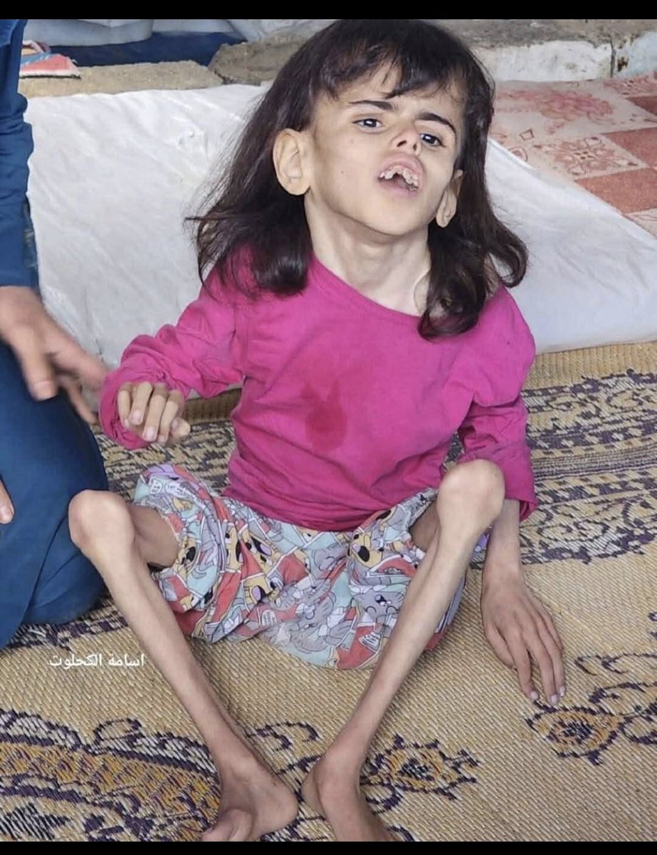 Dünyada çocuklar bu hale geliyor ve biz izliyoruz delirmemek elde değil  #EgyptWakeUpForGazaMısır