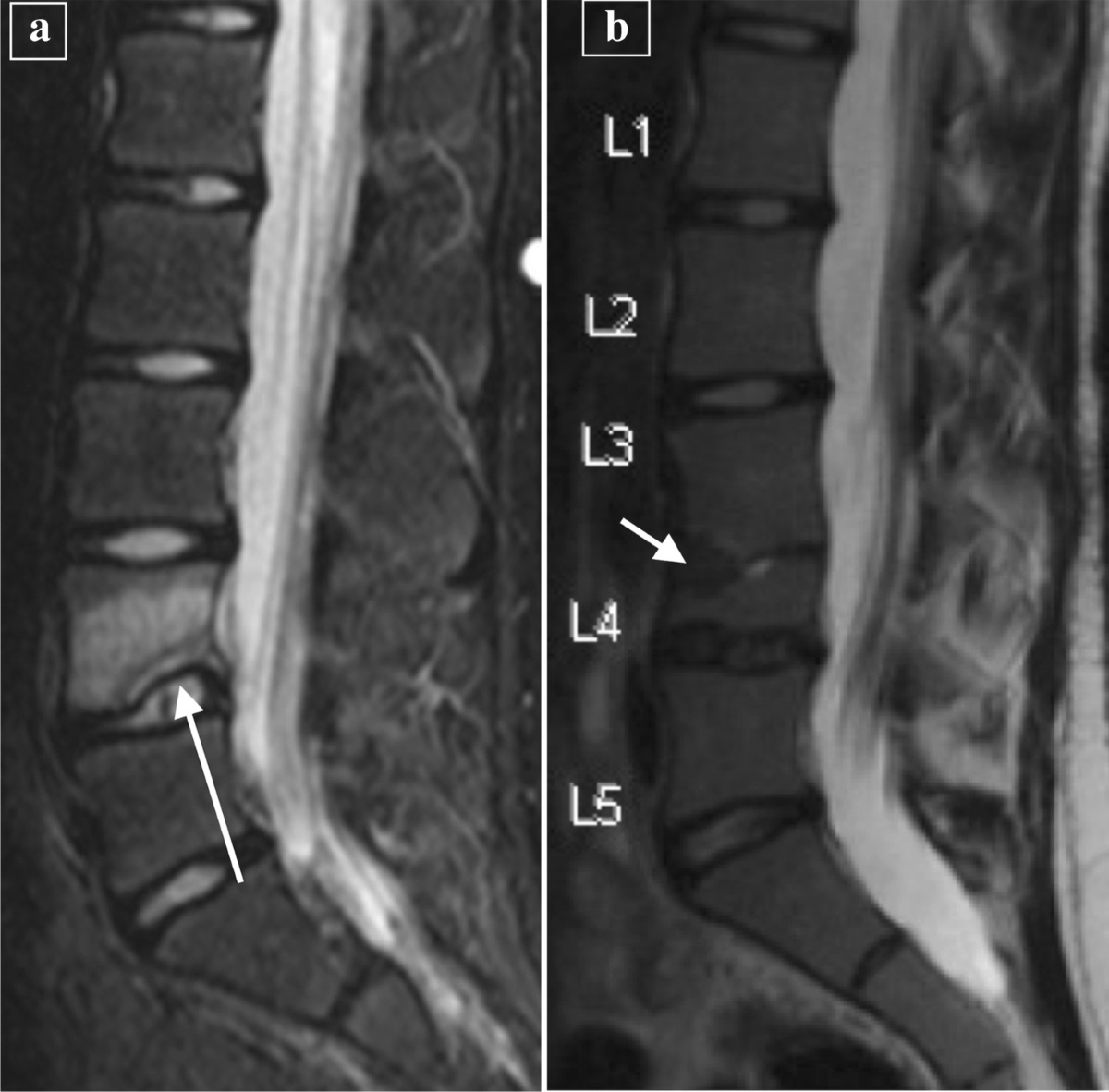 MedEd_Cases's tweet photo. This was a 24 year old male presenting with back pain and fever…
Watch: https://t.co/VCoGTQRo01
Read: https://t.co/R5IkdpkVZA
#MedEd #MedicalEducation #Medicine #MedSchool #MedStudent #physicianassistant #nurse #doctor #nursepractitioner #paschool #medicalschool #palife #physicianassistantlife #nursing #EmergencyMedicine #Neurosurgery #InfectiousDisease