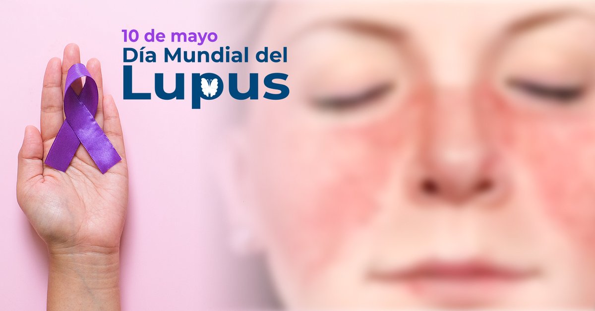 Hoy 10 mayo, es el Día Mundial del Lupus, enfermedad autoinmune que afecta 9 veces más a mujeres que a hombres. Sus síntomas incluyen fatiga, dolor articular y un característico "eritema en mariposa". Aunque no tiene cura, con tratamiento adecuado puede controlarse.🦋💜