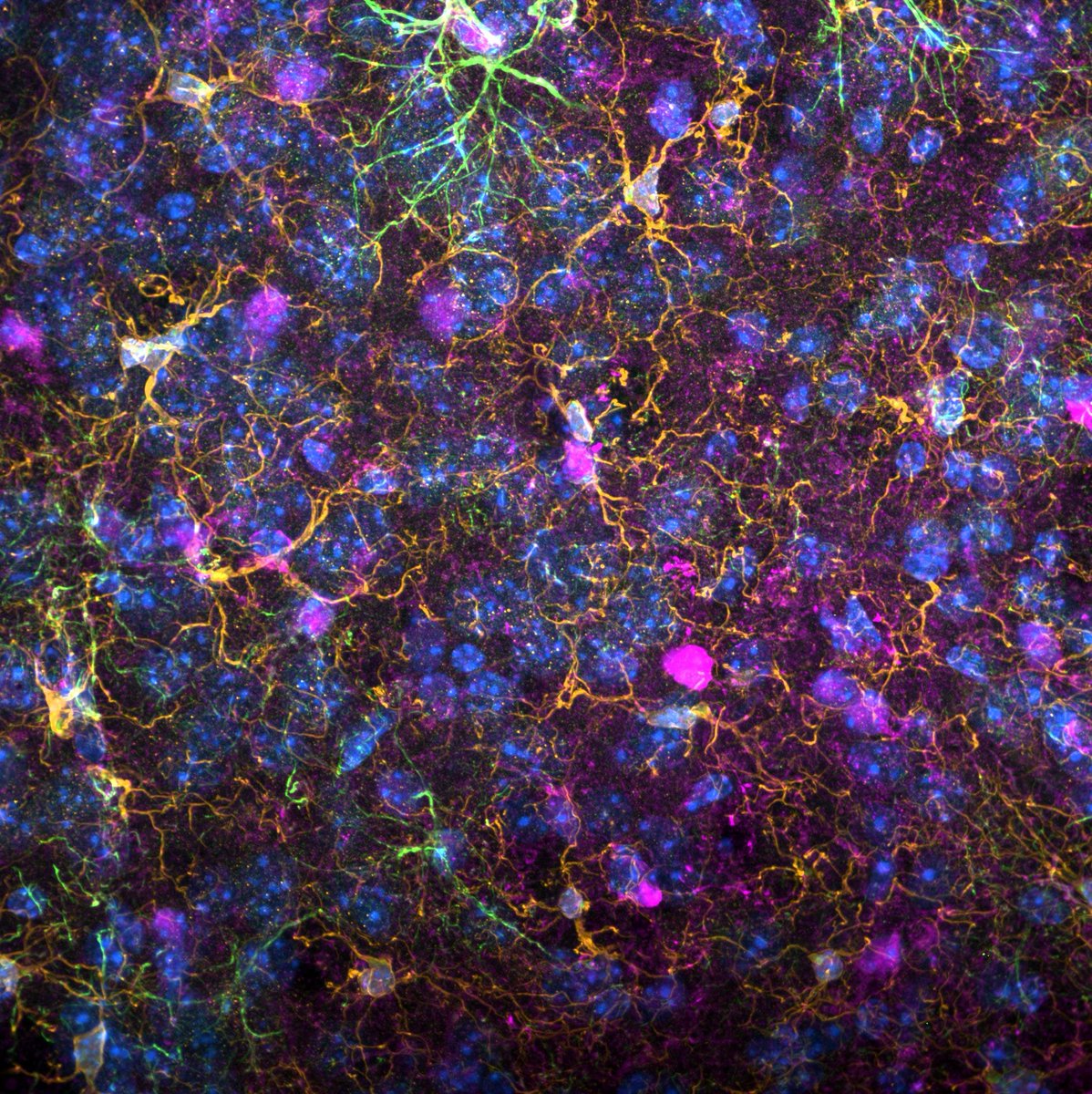 Canxuki's tweet image. For this #FluorescenceFriday I share a beautiful picture of the brain taken my PhD student @MandiLicht. Orange: Iba1, green: GFAP, magenta: S100b and blue: DAPI.

#ProudPI