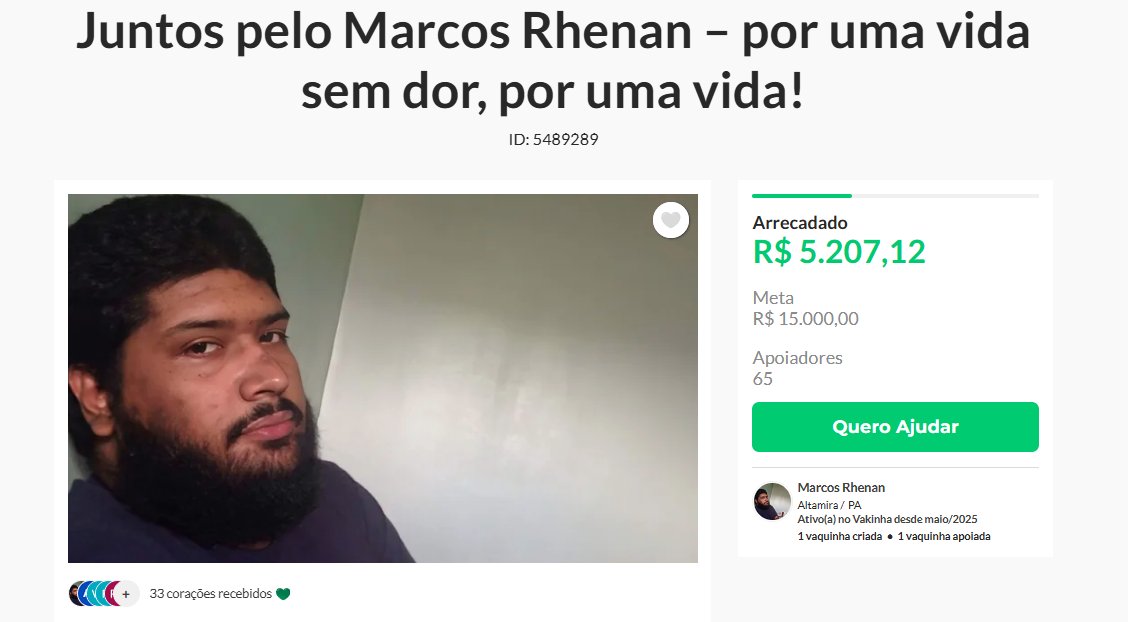 Ingoorda's tweet photo. Ajude o Marcos Rhenan a vencer essa batalha pela vida!
Ele luta há anos contra uma doença autoimune gravíssima: Dermatite psoriasiforme superficial (psoríase CID10 L40.0). https://t.co/7hmdeR7jty