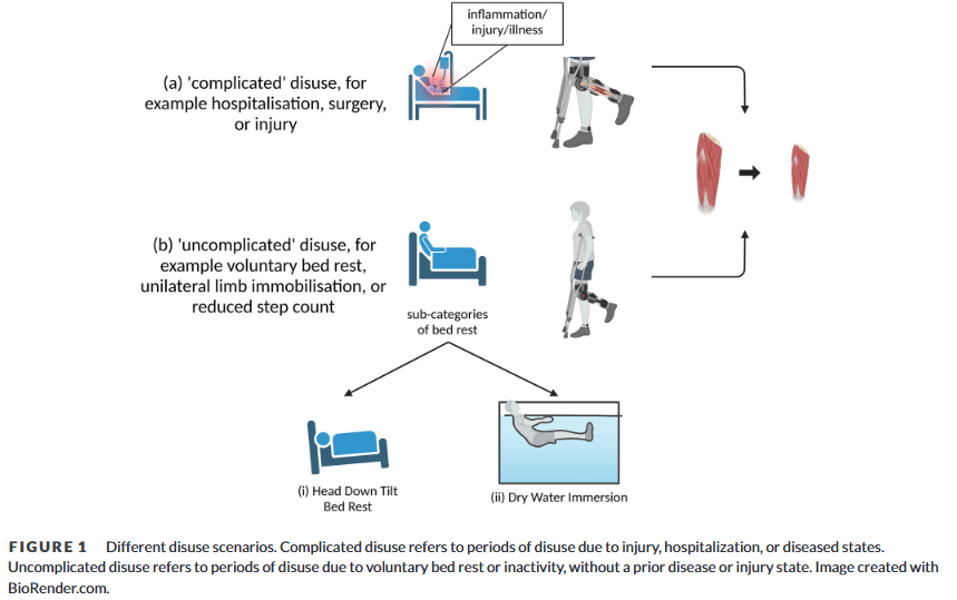 Dr. Myohead (@drmyohead) on Twitter photo Protein-based perioperative nutrition interventions for improving muscle mass and functional outcomes following orthopaedic surgery
Nice read from <a href="/OllyWitard/">Oliver Witard</a> <a href="/_PaulMorgan/">Paul Morgan</a> <a href="/MogwaiBeth/">Beth Phillips</a> et al
doi.org/10.1113/EP0922… Protein-based perioperative nutrition interventions for improving muscle mass and functional outcomes following orthopaedic surgery
Nice read from <a href="/OllyWitard/">Oliver Witard</a> <a href="/_PaulMorgan/">Paul Morgan</a> <a href="/MogwaiBeth/">Beth Phillips</a> et al
doi.org/10.1113/EP0922…