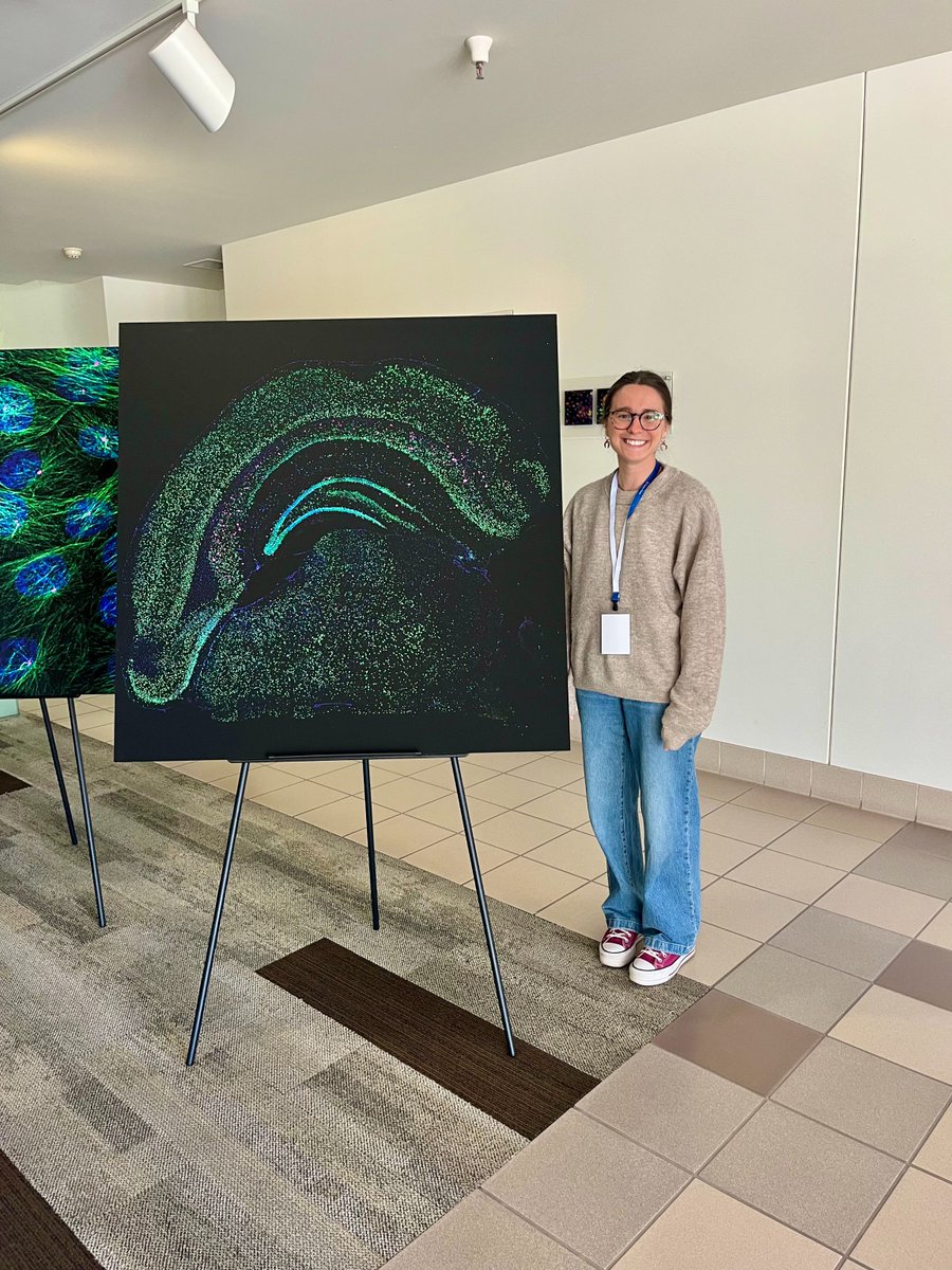 Congratulations to CIBS' graduate student, Helena Cortes Flores! Helena took 2nd place at the Microscopy Imaging Contest organized by the Microscopy Shared Resource in the UA Cancer Center. 

What a beautiful  image of the brain!