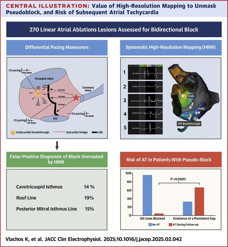 Radosław Lenarczyk (@rlenarczyk) on Twitter photo High-resolution mapping bests differential pacing in evaluating atrial linear block in pts after #AT/pers #AF #ablation- DP false-positive in 3⃣7⃣% of CTI, 4⃣0⃣% of roof, 5⃣4⃣% of mitral isthmus lines👇
sciencedirect.com/science/articl…
<a href="/RolandTilz/">Roland Tilz</a> <a href="/SergeBoveda/">Serge Boveda</a> <a href="/VKutyifa/">Valentina Kutyifa</a> <a href="/purerfellner/">Dr. Helmut Pürerfellner</a> High-resolution mapping bests differential pacing in evaluating atrial linear block in pts after #AT/pers #AF #ablation- DP false-positive in 3⃣7⃣% of CTI, 4⃣0⃣% of roof, 5⃣4⃣% of mitral isthmus lines👇
sciencedirect.com/science/articl…
<a href="/RolandTilz/">Roland Tilz</a> <a href="/SergeBoveda/">Serge Boveda</a> <a href="/VKutyifa/">Valentina Kutyifa</a> <a href="/purerfellner/">Dr. Helmut Pürerfellner</a>