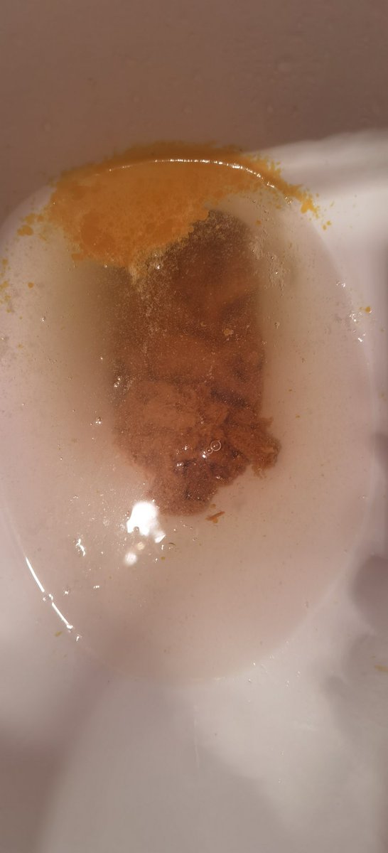 吃螃蟹的季节快到了，朋友说不知道怎么绑螃蟹，要拿我练练手.....
.......（绑完之后）.......
喂！我不是真螃蟹啊！那个东西不是蟹黄啊！！！