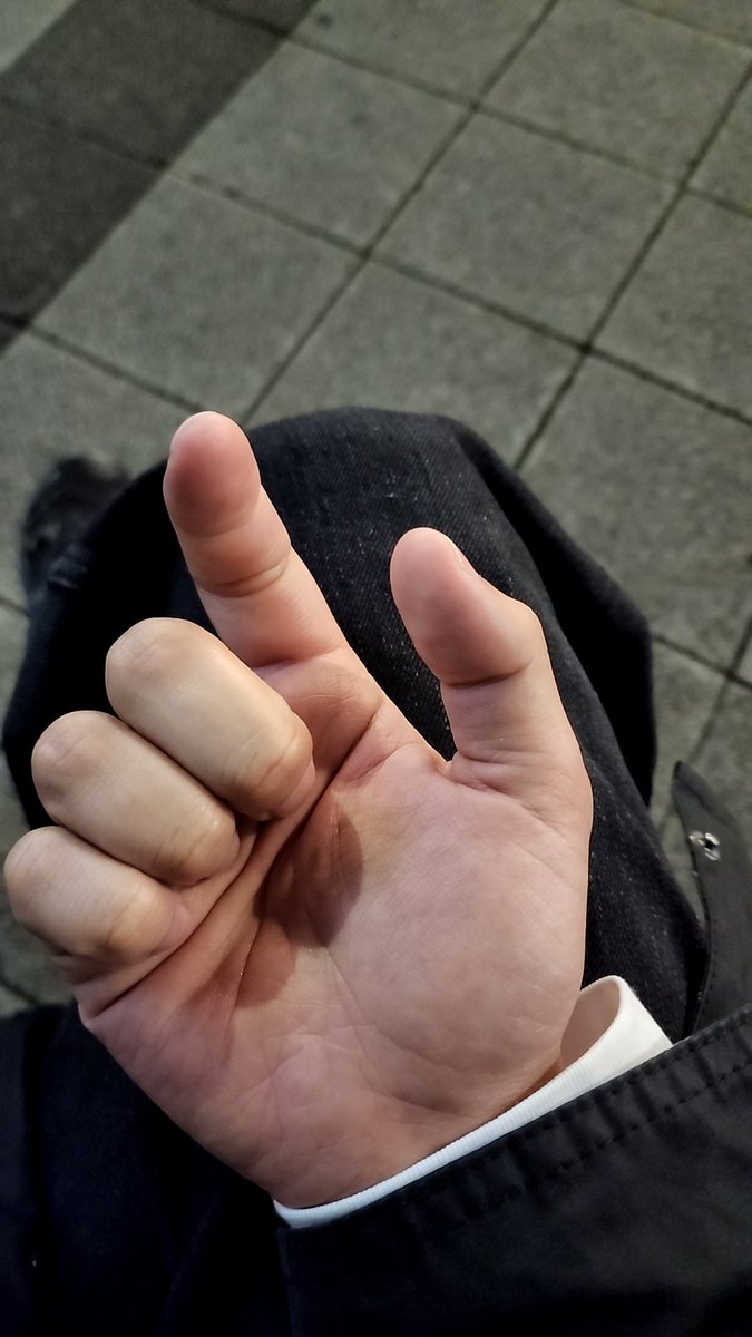 mikewazowskiMM's tweet image. 右手が痛すぎて、全力で握ろうとしてこんな感じ。整形外科行きたいけど明日どこも休診。。
さあ、次はどのような病気だ。