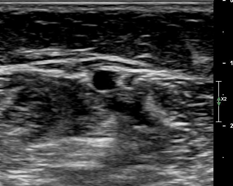 Marcos A. P. Borges, MD 🇧🇷 tweet media