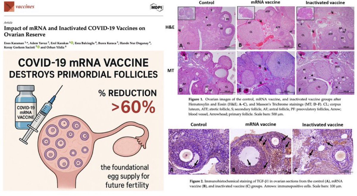 🚨 TIN MỚI NHẤT: Các mũi tiêm mRNA phòng ngừa COVID-19 phá hủy hơn 60% nguồn cung cấp trứng không tái tạo của phụ nữ

Nghiên cứu mới phát hiện ra rằng chuột được tiêm bắp với liều mRNA tương đương với liều của con người bị mất nang nguyên thủy không