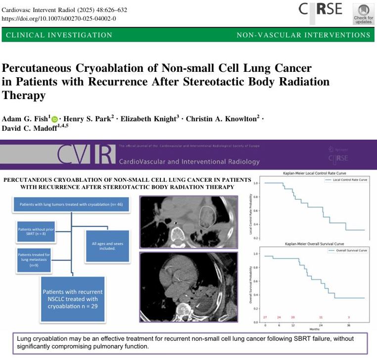 David C. Madoff, MD (@dcmadoff) on Twitter photo Hot off the press in <a href="/CVIR_Journal/">CVIR Journal</a>! Our team at <a href="/YaleMed/">Yale School of Medicine</a> evaluated percutaneous #cryoablation for NSCLC recurrence after #SBRT, a challenging clinical scenario with few safe options. In 29 patients (35 sessions), we observed:
- 100% technical success
- Local control: 100% at 6 Hot off the press in <a href="/CVIR_Journal/">CVIR Journal</a>! Our team at <a href="/YaleMed/">Yale School of Medicine</a> evaluated percutaneous #cryoablation for NSCLC recurrence after #SBRT, a challenging clinical scenario with few safe options. In 29 patients (35 sessions), we observed:
- 100% technical success
- Local control: 100% at 6