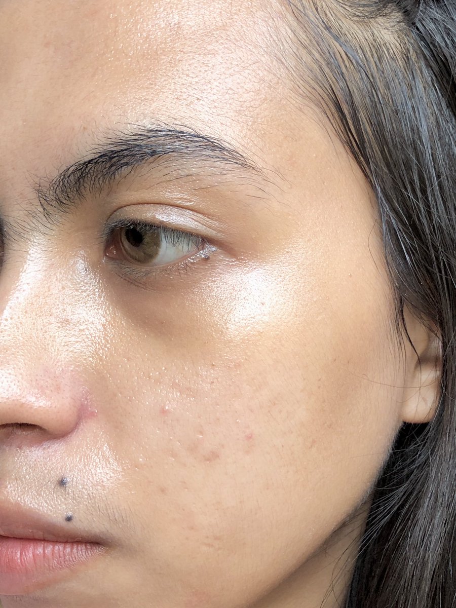 cuaeu's tweet photo. Serum Vitamin C yang nampol buat mencerahkan muka kusam sekaligus memudarkan bekas jerawat😚

Aman dikulit acne prone… Harganya mulai dari 20rb-an ajaaa😭🙏🏼 https://t.co/dGV5hj4o6J