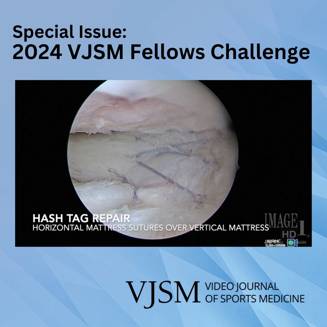 aossmjournals's tweet image. New from VJSM: Tensionless Repair of Lateral Radial Meniscus Tear with the Use of Traction Stitch

ow.ly/m6Jh50VLCYt

 #MeniscusTear #KneeHealth