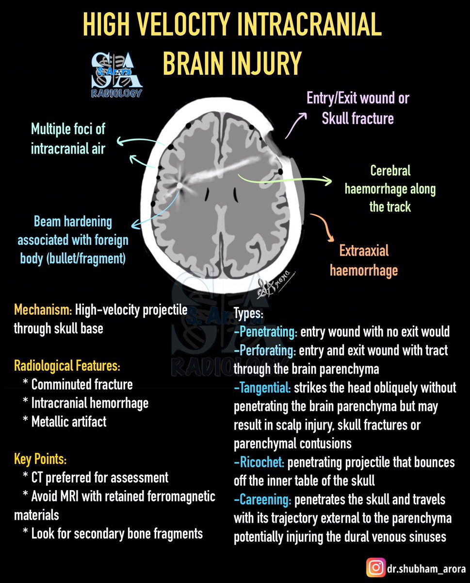 Dr_S_Arora's tweet image. The ongoing conflict underscores the importance of understanding the radiological findings associated with projectile injuries. While we hope for a lasting ceasefire, it remains crucial to be prepared—ideally with knowledge we never need to use.
#radiology #IndiaPakistanConflict