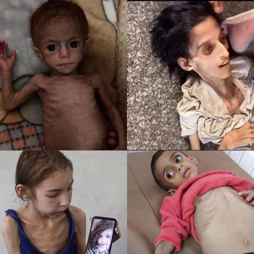 These are the children of Gaza .

Children's hunger is a painful sight. Children's hunger is the end of humanity. They went hungry not because there was no bread... they went hungry because the world decided to deprive them .