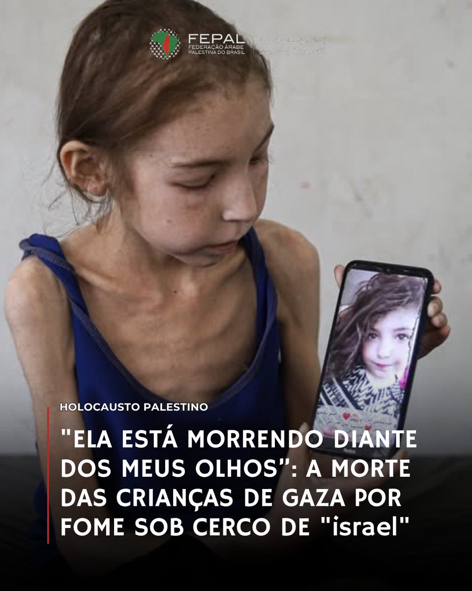 “Ela está morrendo diante dos meus olhos”: a morte das crianças de Gaza por desnutrição sob cerco de “israel”

Com mais de 70 mil crianças hospitalizadas por desnutrição, o bloqueio imposto por "israel" à Faixa de Gaza tem deixado os pais impotentes, assistindo seus filhos