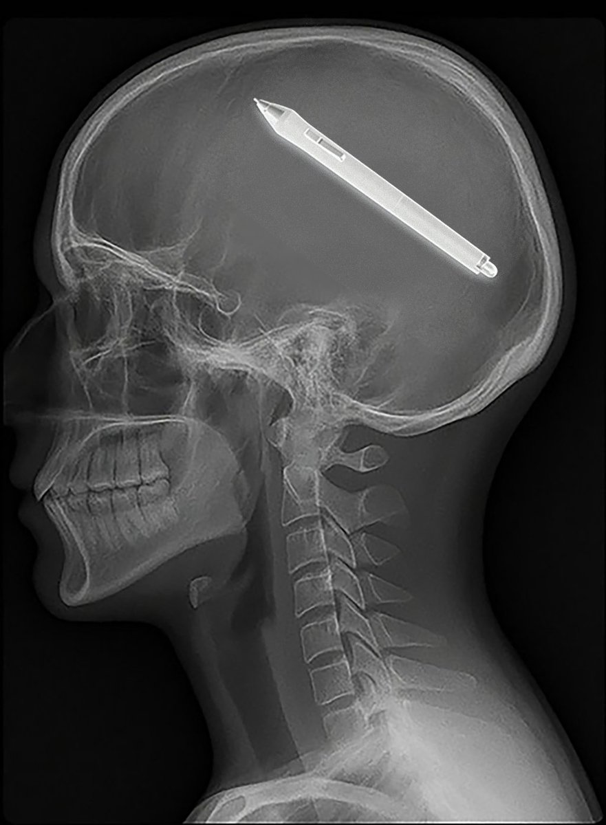 Macroblock (@sainimatic) on Twitter photo 