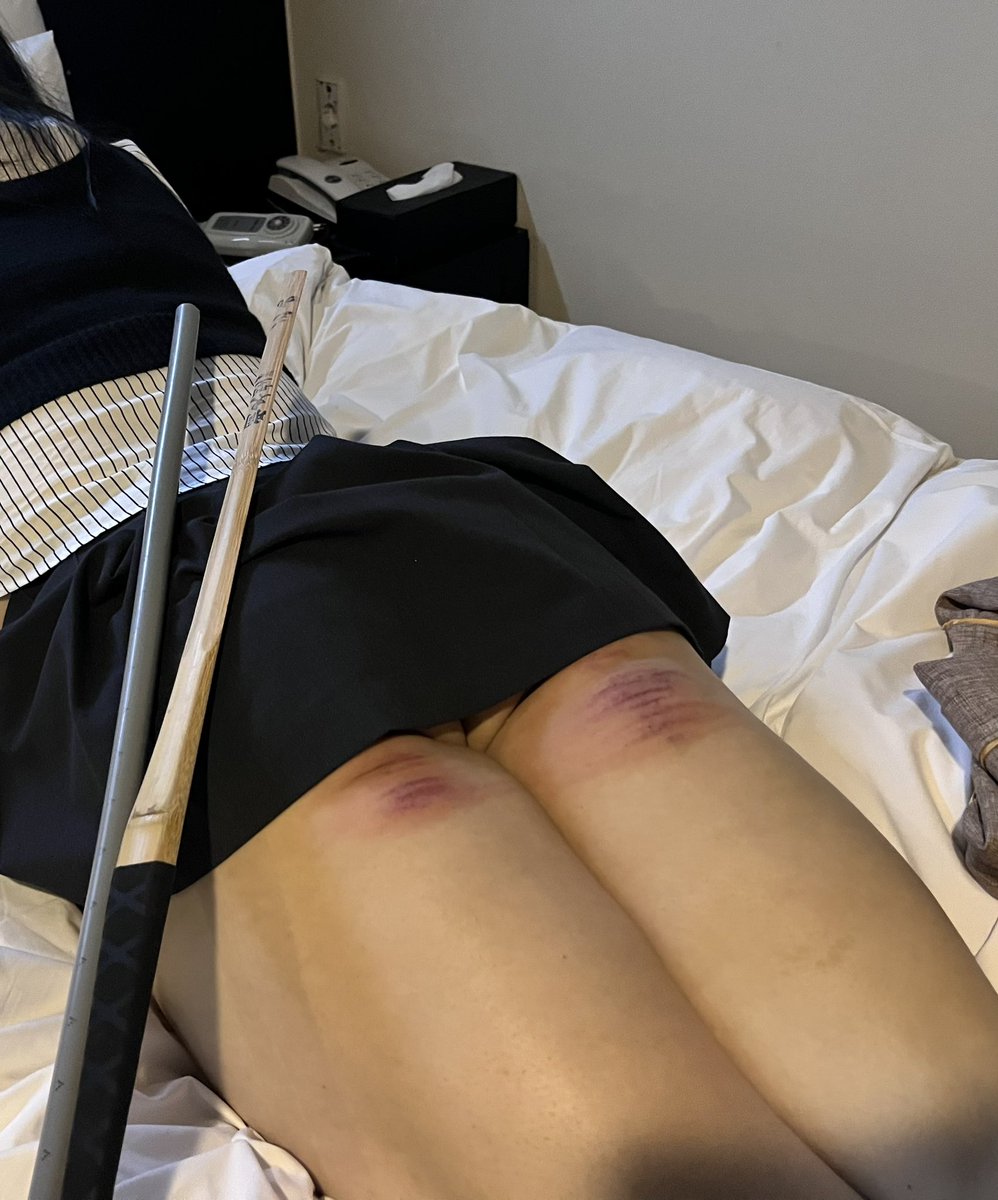 이번에 엉벅지만 집중 타격하신 주인님🤣

엉벅지 아파하는 부위고
잘 무너지는 부위인데
집중적으로 

윗엉덩이는 깨끗하고
엉벅지만 자국이 있다

아파서 허리올라오면
바로 발바닥 ㅠ

발바닥도 넘 아파😣