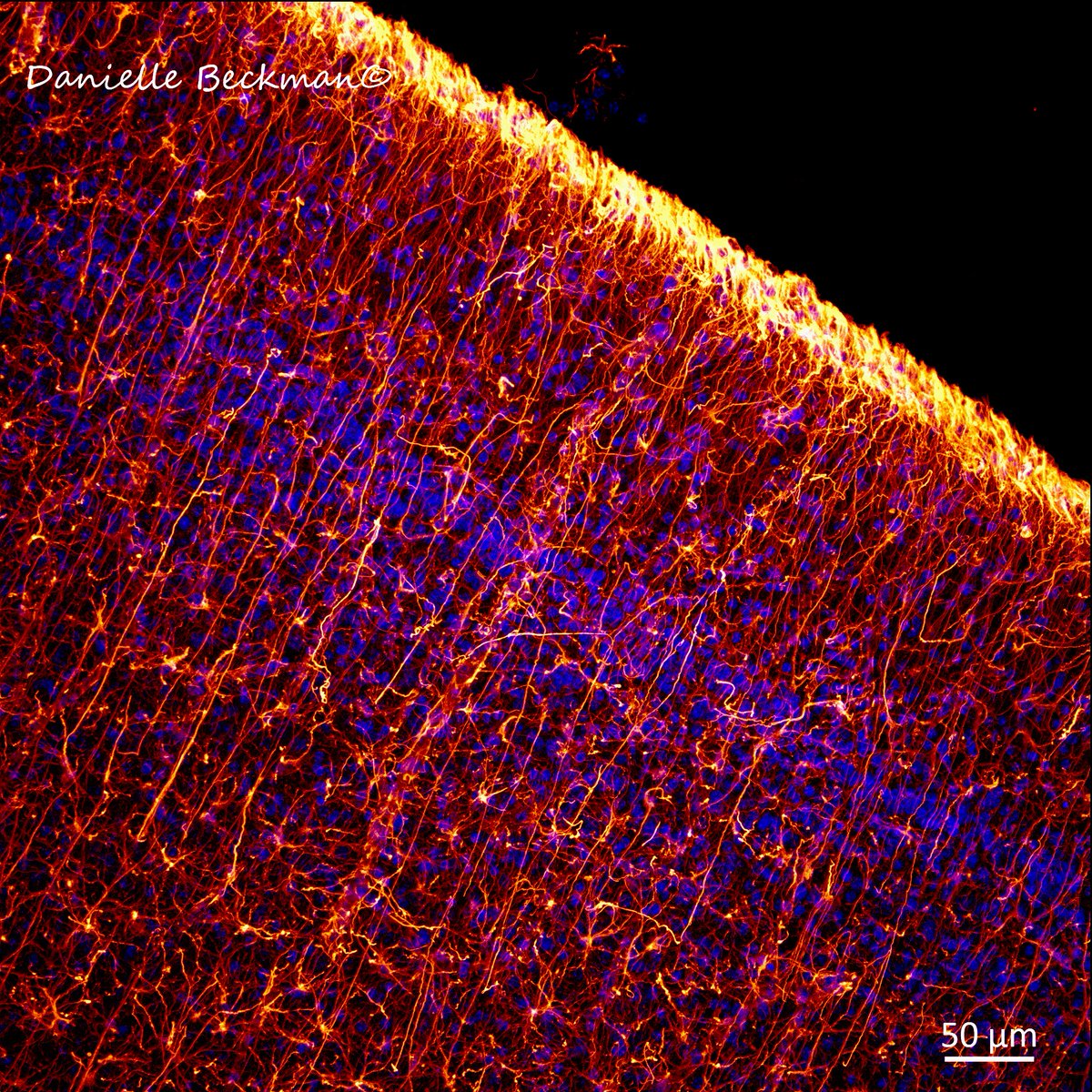 How do neurons know their final position in the brain? Using a combination of chemical signals &amp; physical guidance by radial glia 🟡. My favorite cell type in the brain is also temporary! After cortical development, most will transform into astrocytes. Nuclei of cells in🔵#SciArt