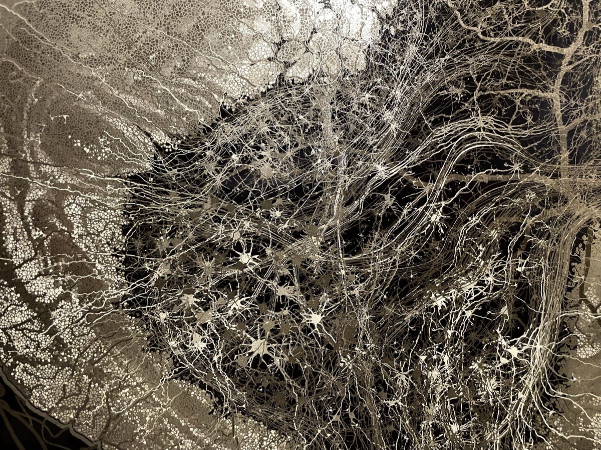 GDunnArt's tweet image. Closeup of the ventral horn and motor neurons of the spinal cord. I did a project back before grad school to laser microdissect these bad boys for transcriptional profiling.
Availalbe as a microetched print here:
shorturl.at/Mqk4t
#spinalcord #spine #chiropractic #sciart