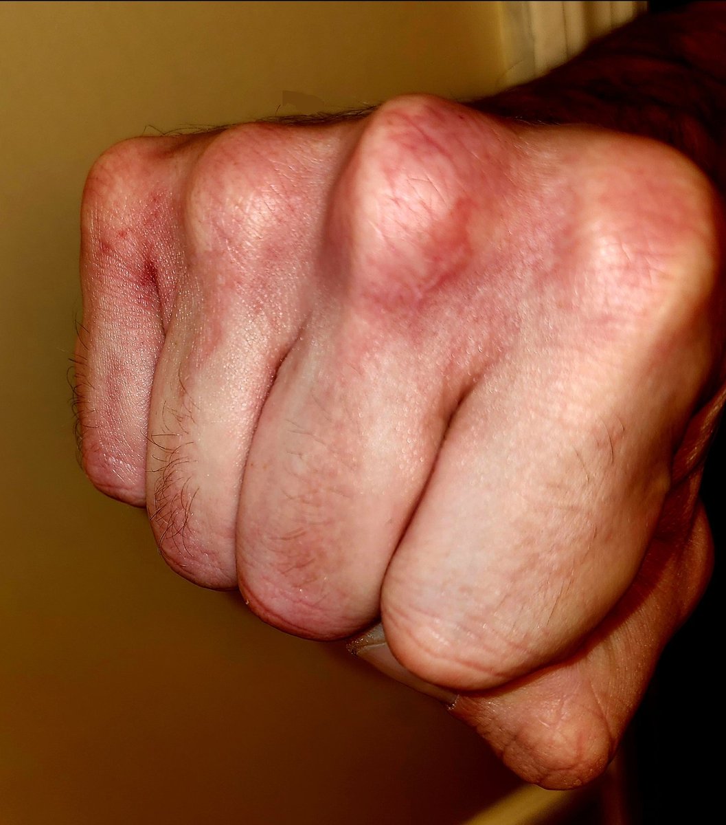 NSRLAC2's tweet image. As long as you use perfect form and have good wrist strength, train bare-knuckled on your heavybag. After years of consistent training, the bones in your hands will become more dense, and your knuckles will be hard as granite. Always spray your knuckles with alcohol afterward. ⚡️