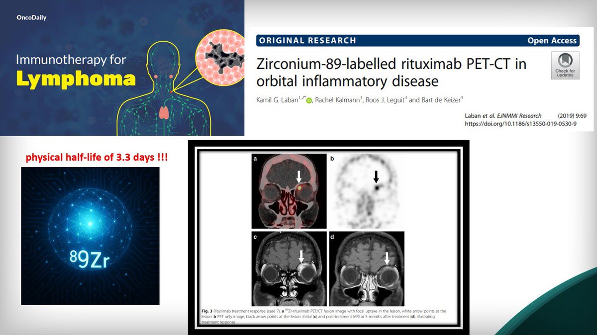 Danny Mena - nuclear medicine (@dandanmena) on Twitter photo Thks <a href="/Grupo_GELL/">Grupo GELL</a> and <a href="/hematologo/">Dr. Luis Villela</a> Luis Mario Villela Martínez for this space to show nuclear medicine contribution with PET-FDG TTV in Lymphoma, and new tracers frontiers !! Thks <a href="/Grupo_GELL/">Grupo GELL</a> and <a href="/hematologo/">Dr. Luis Villela</a> Luis Mario Villela Martínez for this space to show nuclear medicine contribution with PET-FDG TTV in Lymphoma, and new tracers frontiers !!