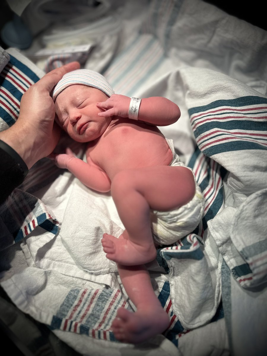 Moco Fire Wire tweet media