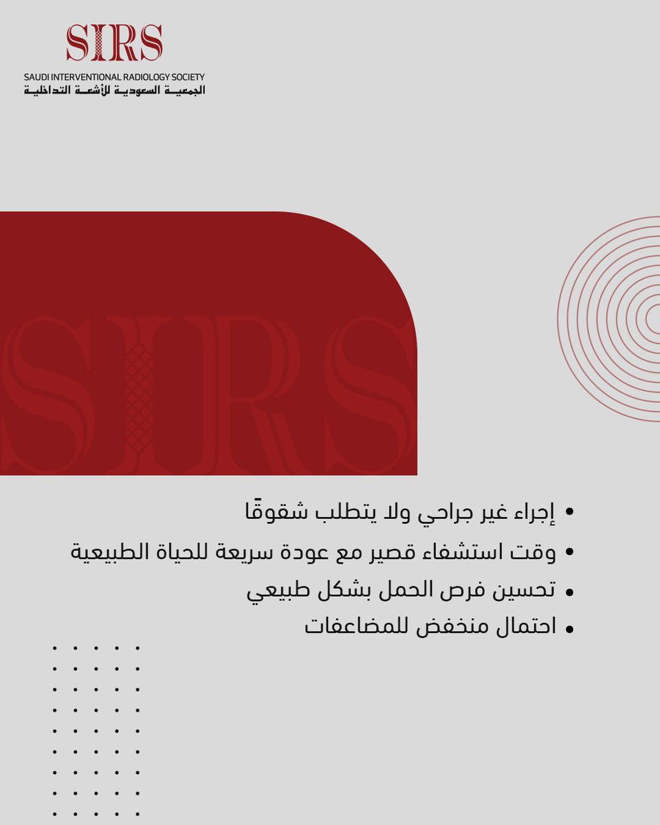 ✨ لماذا تختارين فتح قنوات فالوب بالأشعة التداخلية؟
✅ بدون جراحة– إجراء آمن وغير مؤلم
  ✅ تعافٍ سريع– عودة سريعة للحياة الطبيعية
  ✅ تعزيز فرص الحمل– استعادة وظيفة القنوات بشكل طبيعي
  ✅ مضاعفات أقل– خيار آمن مقارنة بالجراحة التقليدية
💡 حل متطور يمنحكِ فرصة جديدة للأمومة بكل
