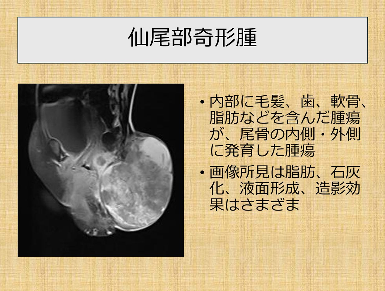 医心方 巻十 積聚・疝か・水腫篇 医心方 巻十 積聚・疝か・水腫篇 医心方 巻10 積聚・