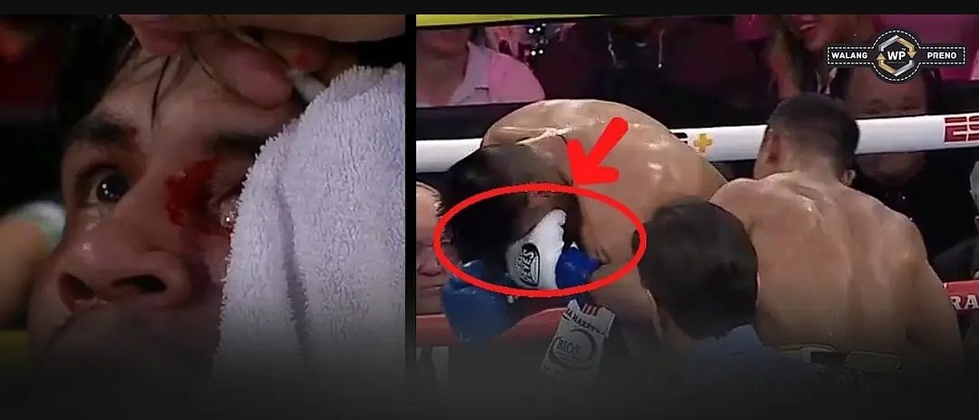 "UPSET OF THE YEAR" become "ROB OF THE YEAR!

SUAREZ SHOULD WON BY TKO BUT DECLARED HEADBUTT!

BOB "THE ROB" ARUM SHOW!