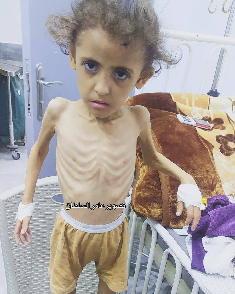 Please explain the difference to me - except that this time we all know and watch it on television