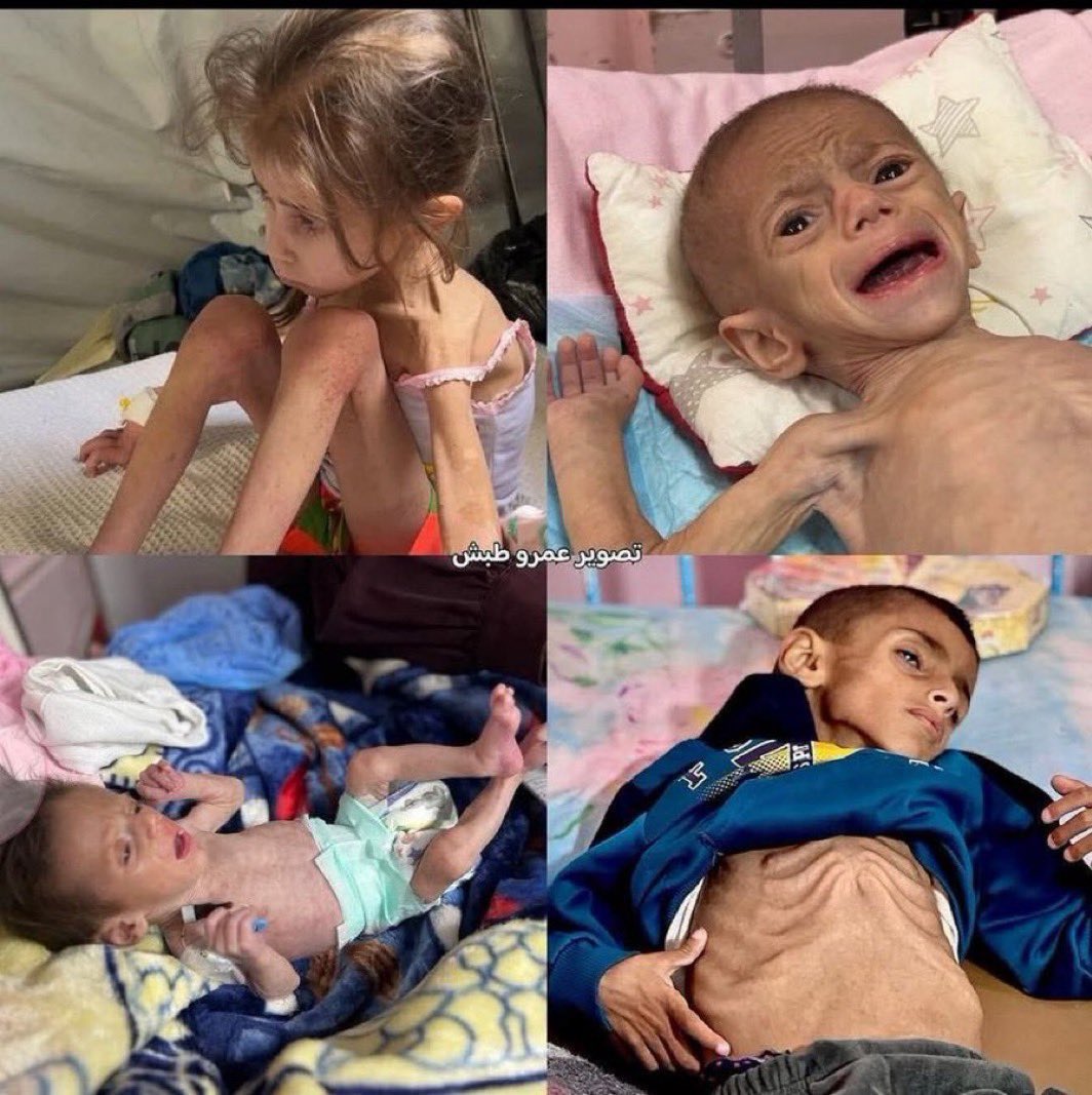 🇵🇸Eng.Abed Rahman_From_Gaza🇵🇸 (@abed1536010) on Twitter photo Look at these little angeles, they are starving 💔!
If you see this pic, reply with 🇵🇸 pray for them 💔
My account is not visible to everyone❗️
If you’re seeing this tweet, please follow my account : <a href="/Abed1536010/">🇵🇸Eng.Abed Rahman_From_Gaza🇵🇸</a> Look at these little angeles, they are starving 💔!
If you see this pic, reply with 🇵🇸 pray for them 💔
My account is not visible to everyone❗️
If you’re seeing this tweet, please follow my account : <a href="/Abed1536010/">🇵🇸Eng.Abed Rahman_From_Gaza🇵🇸</a>